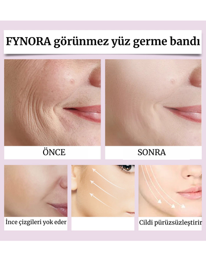 FYNORA Görünmez Yüz Germe Bandı